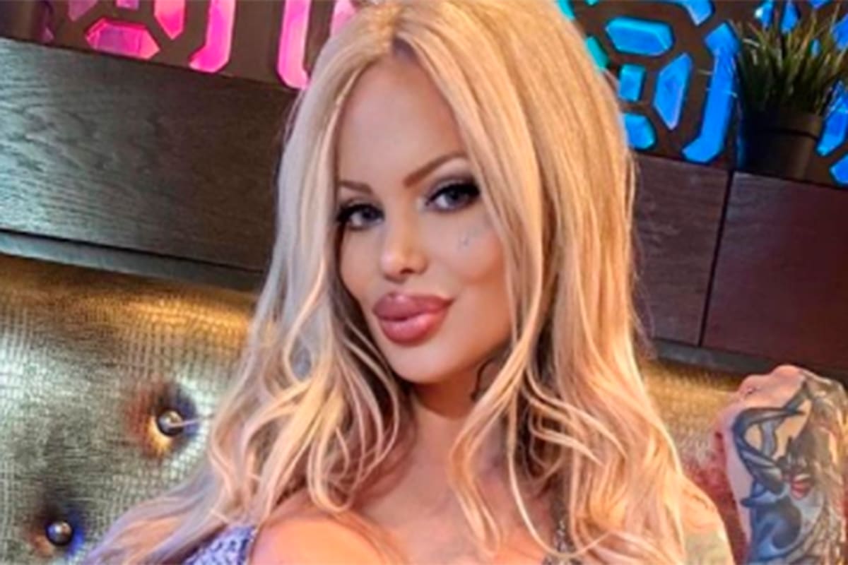 De tanto bótox y relleno, la modelo Sabrina Sabrok perdió parcialmente la movilidad de su cara