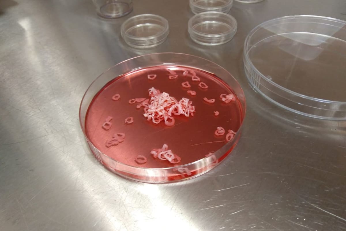 Debido a su tendencia innata a contraerse, forman anillos