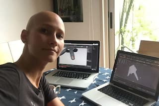 "¿Por qué a mí?": la mujer que se quedó pelada a los 21 años y reinventó su vida