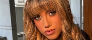 Denisse Gonzáles de Gran Hermano confirmó qué enfermedad padece: “No se sabe la causa que la provocó”