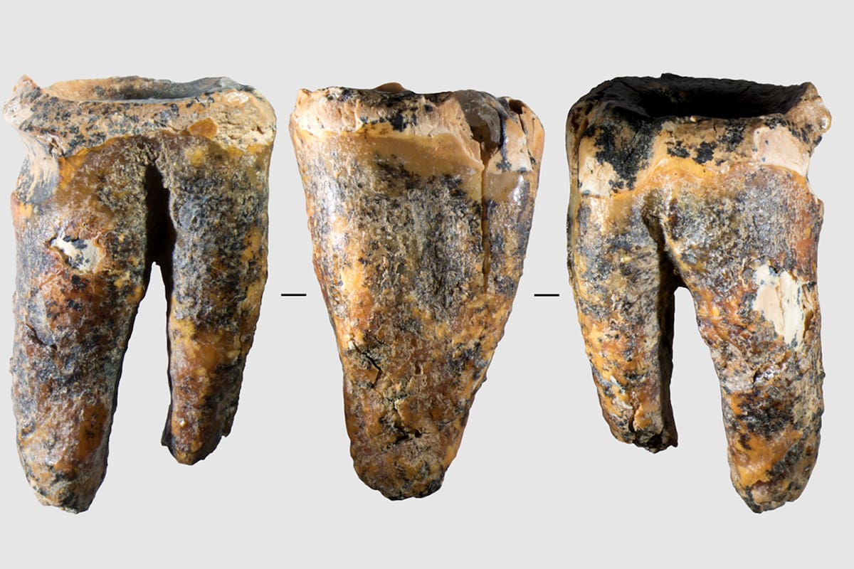 Dentistas milenarios: descubren un diente de hace 59.000 años con tratamientos para las caries