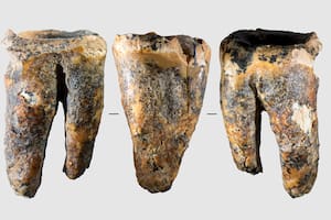 Dentistas milenarios: descubren un diente de hace 59.000 años con tratamientos para las caries