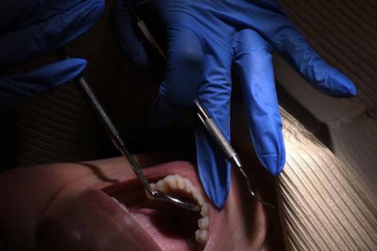 Dentro de la boca viven más de 700 especies de bacterias, algunas que son útiles, otras que son dañinas