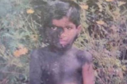 Desde niño, Prabhulal Prasannan sufrió todo tipo de burlas y hositgamiento por parte de otros niños y compañeros de escuela
