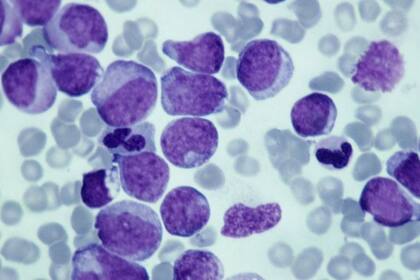 Desde un punto de vista evolutivo, hay hipótesis que pueden explicar la aparición del cáncer y la similitud de sus atributos