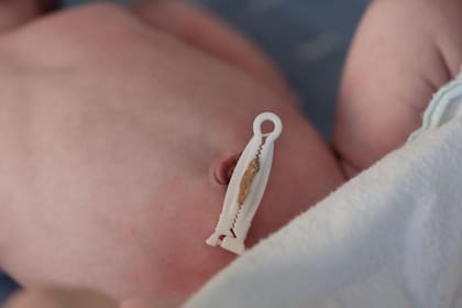 Después de cortar el cordón umbilical, ese pequeño muñón que queda puede ser útil en bebés que nacen con problemas de salud