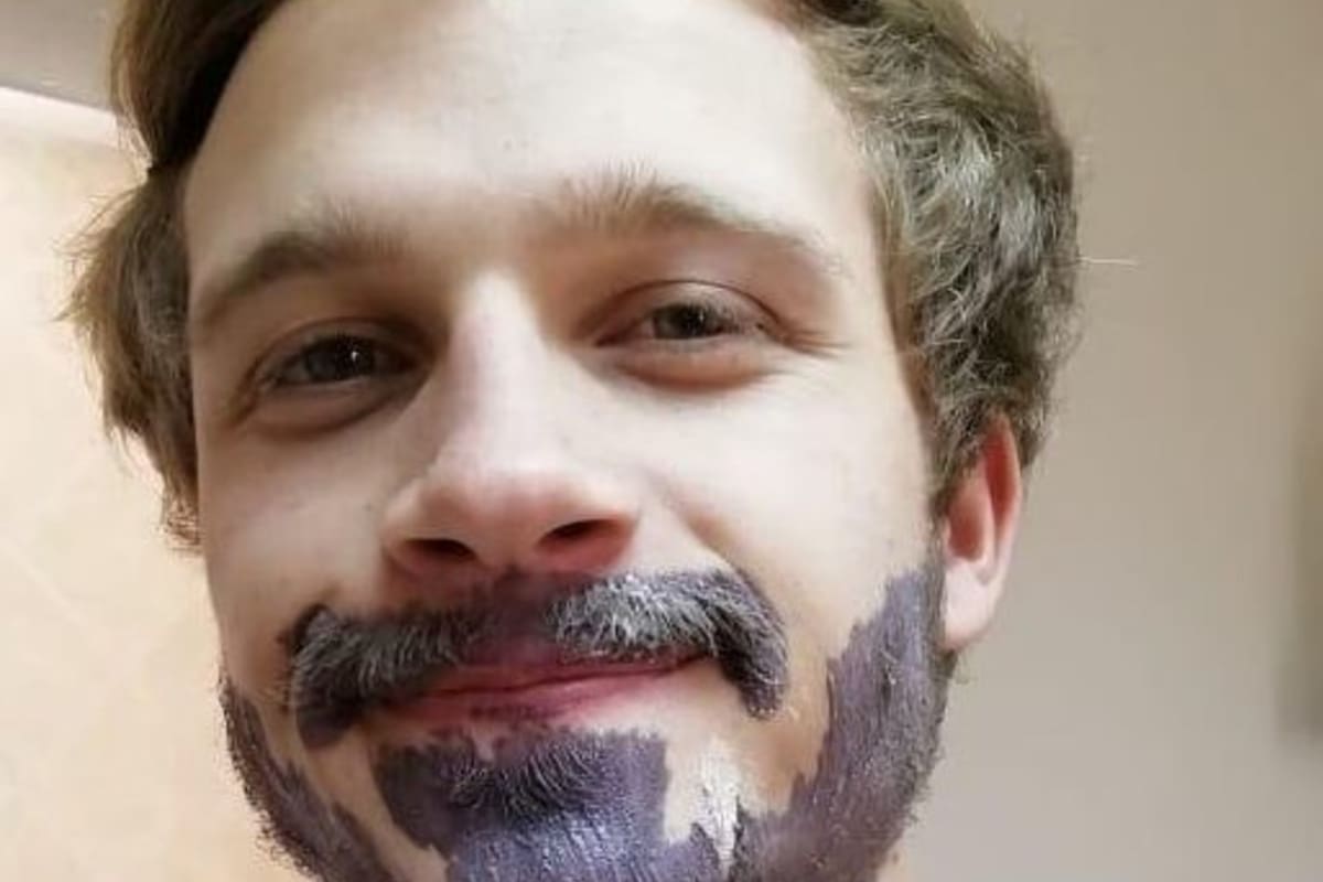 Después de que su novia lo convenciera, Marno Botha se tiñó la barba y terminó con una grave reacción alérgica