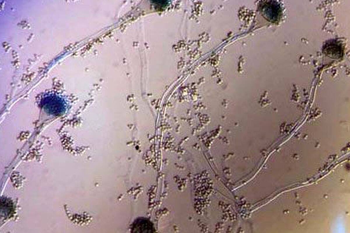Detectan un hongo que causa infección en pacientes graves con coronavirus. Una imagen del hongo que afecta a los pacientes con Covid en terapia.