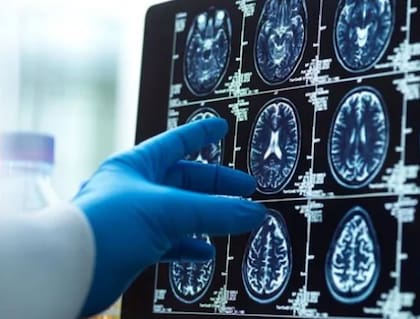 Determinados alimentos podrían contribuir a disminuir la aparición de estos episodios