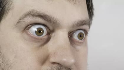 Detrás de los ojos saltones puede haber un problema de la glándula tiroides.