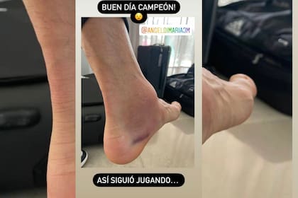 Di María, con el tobillo golpeado, después del partido con Brasil.