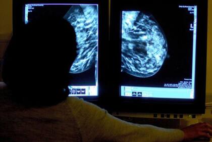 Día Mundial de la Lucha contra el Cáncer de Mama: 6 factores que aumentan el riesgo de padecerlo