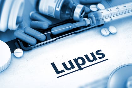 Día Mundial del Lupus: cómo es la lucha contra esta enfermedad que aún no tiene cura