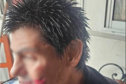 Dos hombres se atacaron con cuchillos en una pensión de La Plata