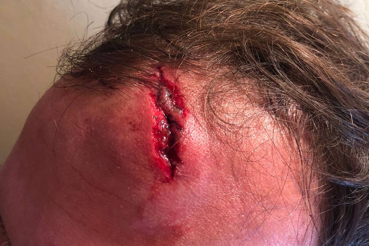 Dos jóvenes fueron agredidos por encapuchados frente al corte de la Ruta 40 en Villa Mascardi