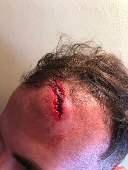 Dos jóvenes fueron agredidos por encapuchados frente al corte de la Ruta 40 en Villa Mascardi