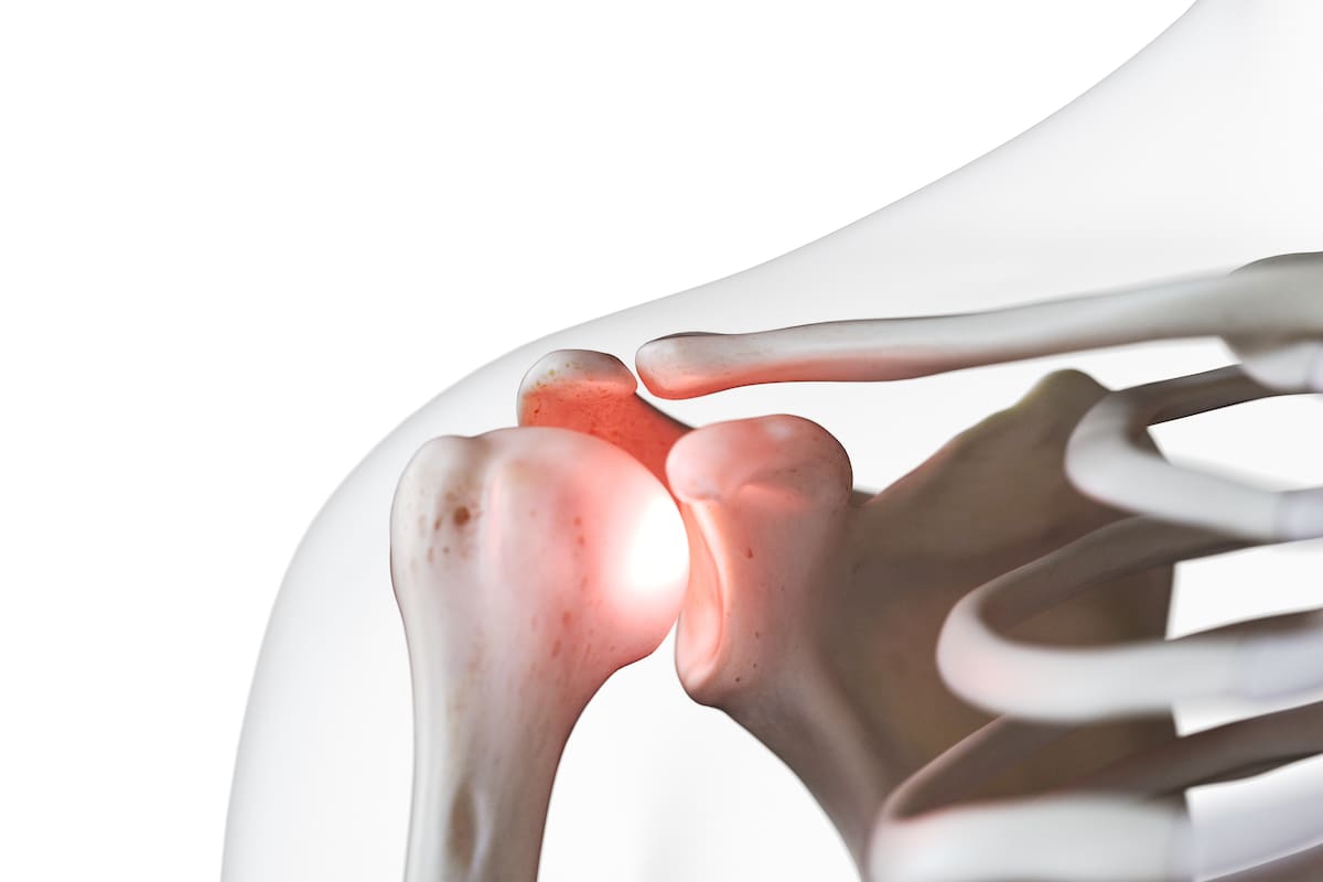 Dos médicos y un biólogo presentaron una terapia biotecnológica que no solo detiene la pérdida de cartílago en las articulaciones, sino que permite regenerarlo. Crearon una startup para lanzar un tratamiento que permitiría curar esta enfermedad, que afecta a unas 500 millones de personas en el mundo y resulta incapacitante