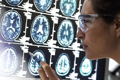 Dos nuevos fármacos mostraron una reducción en el deterioro cognitivo que causa la enfermedad de Alzhemeir
