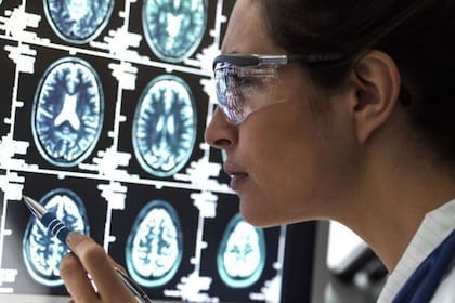 Dos nuevos fármacos mostraron una reducción en el deterioro cognitivo que causa la enfermedad de Alzhemeir