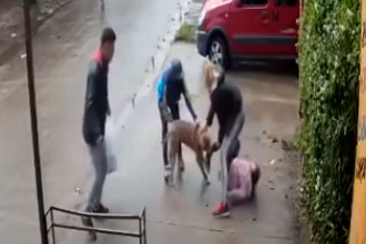 Dramático ataque de un pitbull a una niña: le provocó fractura expuesta en una de sus piernas