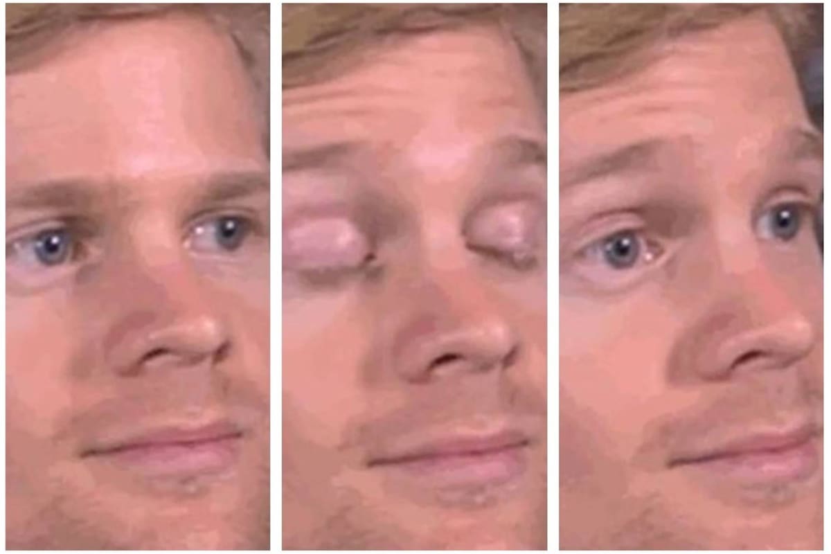 Drew Scanlon es el protagonista del meme "hombre parpadeante"