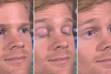 Drew Scanlon, más conocido como "el hombre que parpadea"