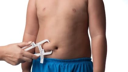 Duque enfatiza que la obesidad no se corrige únicamente restringiendo calorías. Requiere identificar alteraciones hormonales, preservar la masa muscular, tratar las comorbilidades y definir un plan de mantenimiento a largo plazo