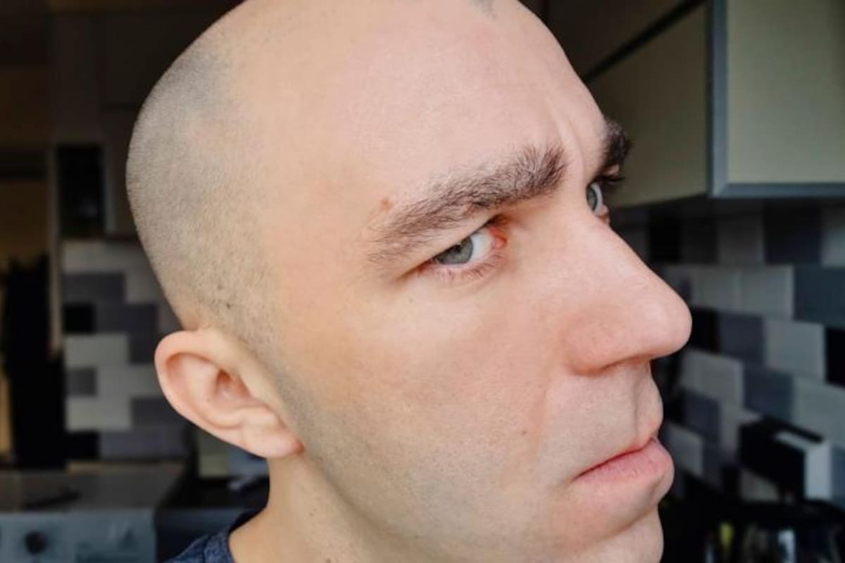 Durante años se creyó que solo las personas blancas se quedaban calvas y que eso las hacía superiores en comparación con los negros o los asiáticos.