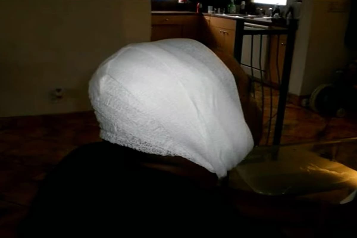 Dwight Turner sufrió heridas severas y estuvo un mes internado. Ahora demanda al santuario animal de Davie, en el estado de Florida