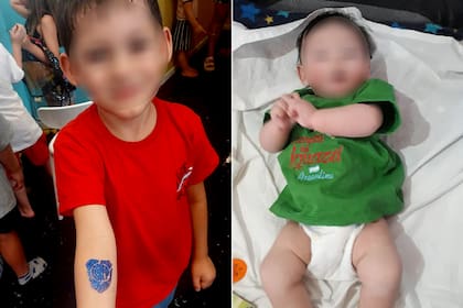 Dylan tiene 5 años y vive en Confluencia, Neuquén; fue diagnosticado con alergias alimentarias múltiples, entre ellas APLV. A la derecha se lo ve de bebé, con el rostro brotado por su enfermedad
