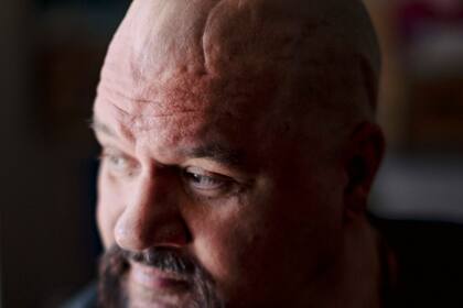 Ed Mowery; Sociedad; NYT; implante