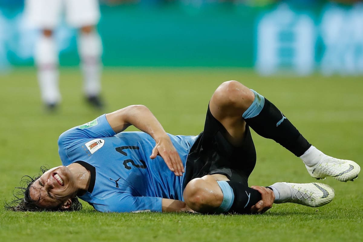 Edison Cavani de Uruguay salió lesionado frente a Portugal