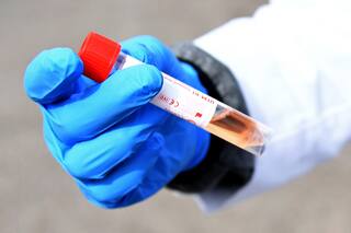 Coronavirus: ¿Por qué también son importantes los falsos positivos?