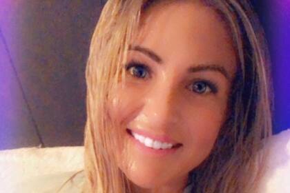 El 18% del cuerpo de Kate Wise sufrió daños por las quemaduras de segundo y tercer grado. El rostro, los brazos y las piernas fueron las zonas más afectadas, por tal motivo pasó varios días en la unidad de cuidados intensivos