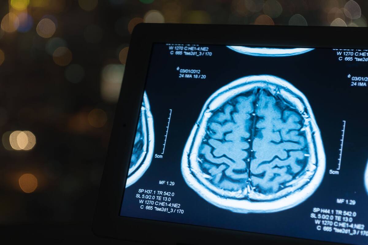 El 22 de julio es el Día Mundial del Cerebro