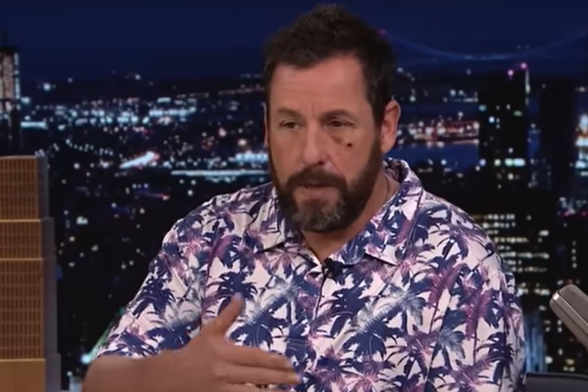 El actor apareció con un golpe debajo del ojo y narró lo ocurrido