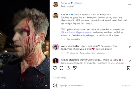 El actor contó que fue amenazado de muerte con un cuchillo y un arma de fuego y que, tras golpearlo, los delincuentes le robaron su reloj (Foto: Instagram @keeoone)