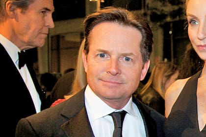 El actor, de 57 años, fue diagnosticado con la enfermedad neurodegenerativa en 1991