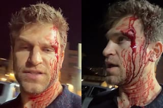 El violento robo a punta de pistola que sufrió Keegan Allen, protagonista de Pretty Little Liars