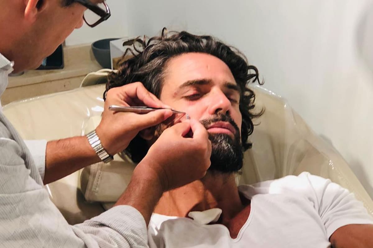 El actor sufrió golpes que no son de gravedad