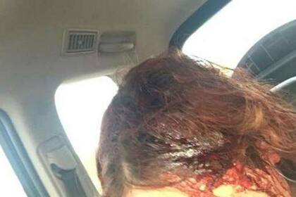 El agresor atacó a una de las chicas con un hacha