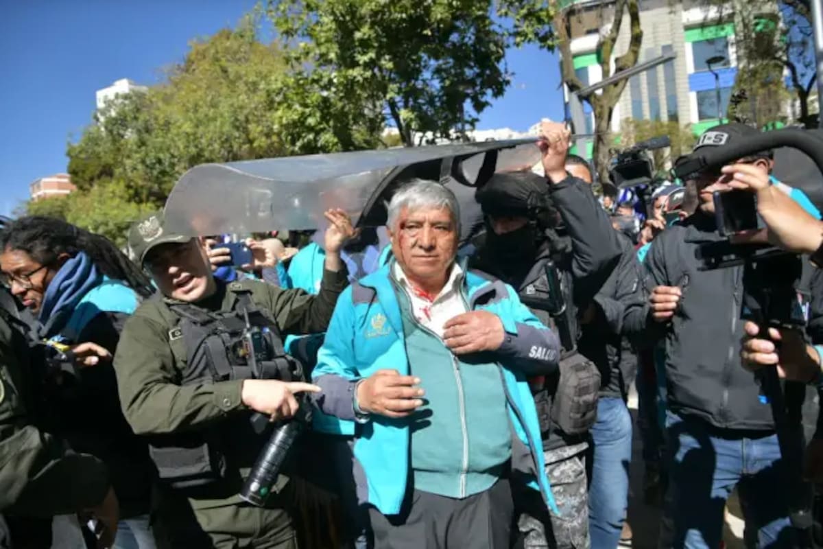 El alcalde de La Paz, Iván Arias (partidario del presidente Luis Arce), herido de un piedrazo en el rostro (Agencia Municipal de Noticias de La Paz)