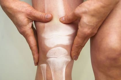 El algoritmo desarrollado en la universidad de Stanford podría ayudar a diagnosticar el dolor de rodilla causado por la osteoartriris