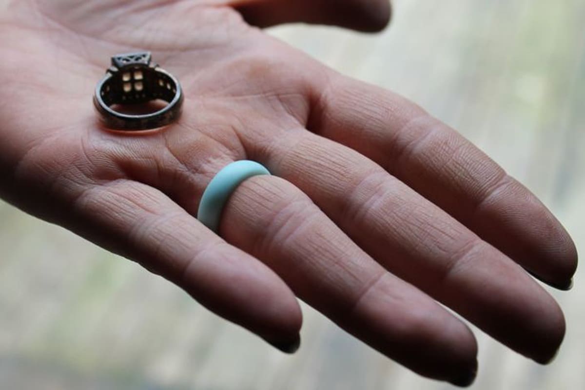 El anillo de bodas de Casey perdió el color debido al nivel de contaminación del agua en su casa. Ahora usa una banda de plástico en su lugar