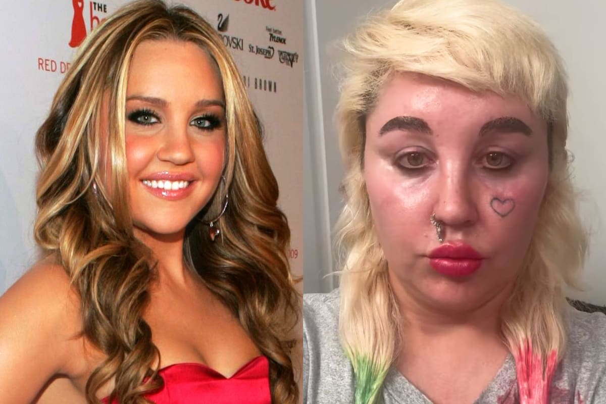 El antes y después de Amanda Bynes: fama temprana, crisis personales y una drástica transformación física