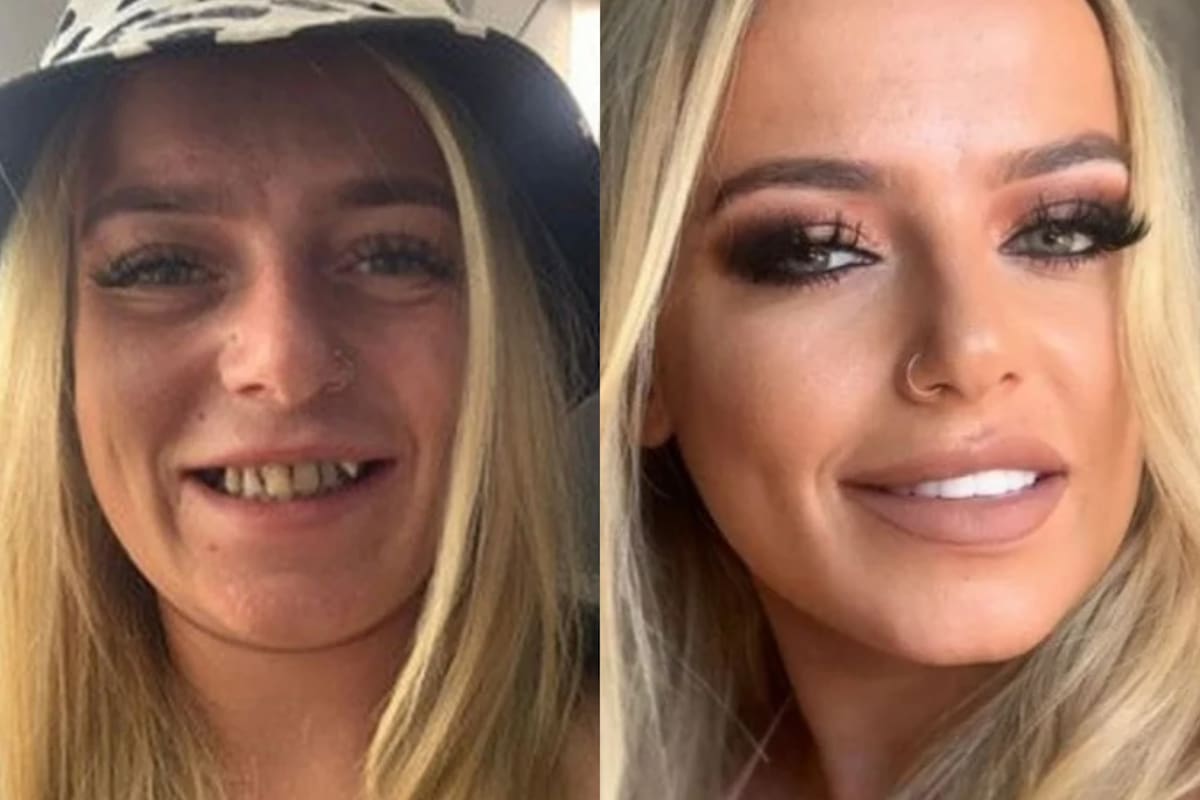 El antes y después de Paige Griffin, la joven inglesa que sufría bullying por su dentadura