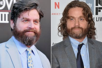 El antes y después de Zach Galifianiakis