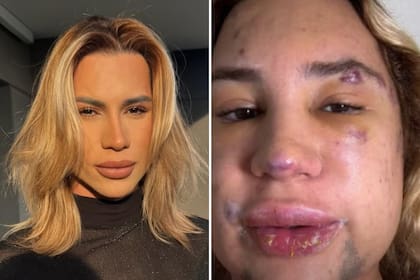 El antes y después del influencer