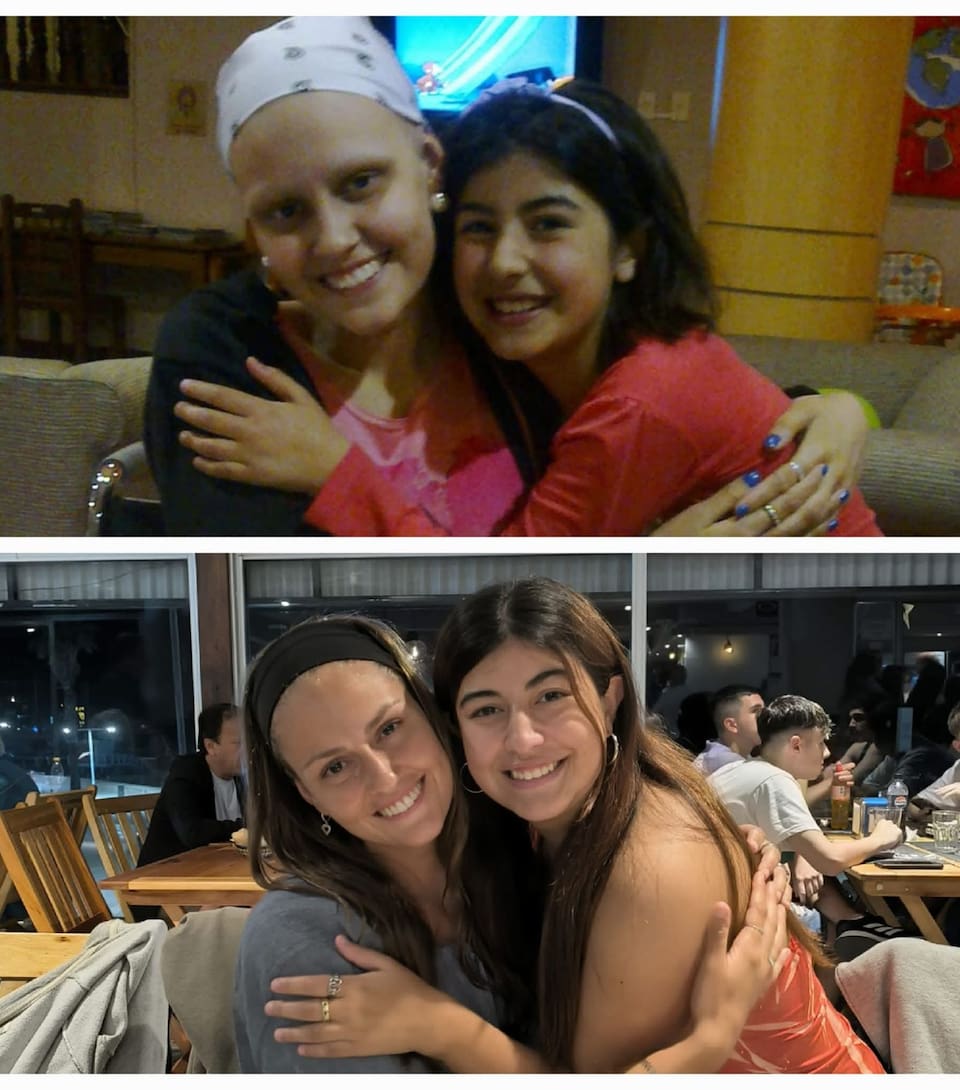 El antes y el después.