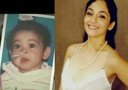 El antes y el después del trasplante.